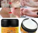 Crema para Pies
